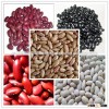 DRIED BEANS | KIDNEY BEANS | SUGAR BEANS