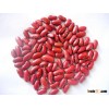 Red Speckled Kidney Beans,Dark Red Kidney Bean,Black, White and Red Kidney Beans