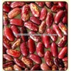 Purple Speckled Kidney Beans big and small size high quality Grade A for sale