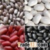 White/Black Light Speckled Kidney Beans (LSKB) Pinto Beans/Sugar Beans Best Price