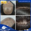 Newtimeshair Injected Silicon hair replacement system both for men women human hair toupee