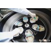 Plasmapheresis Method
