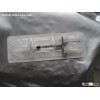 Hyaluronic Acid Injection