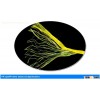 pp split film rope