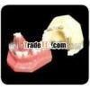 natural size removable dental tooth implant model