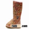 UGG Boots can make you fashionable