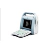 KAIXIN Ophthalmic ultrasound scanner