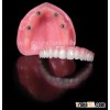 Bright Implants