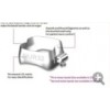 Orhodontic Molar bands