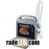 colour doppler--Zonc-v3