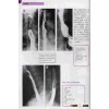 Medical x-ray double-side laser printing film